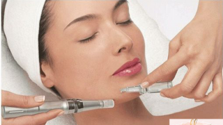 plaatsen foto epilatie rotterdam Microneedling Rotterdam & laser ontharen  Diamonds Beauty Salon